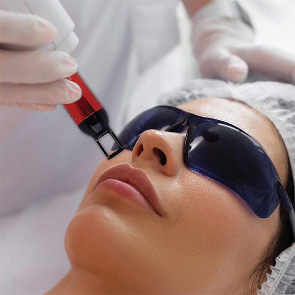 Clear Diamond Laser Treatment
